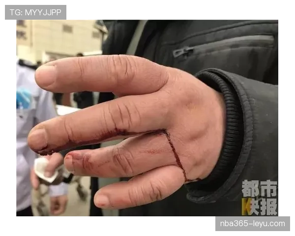 阿什拉夫大腿伤势引关注：康复进程与长期影响成焦点